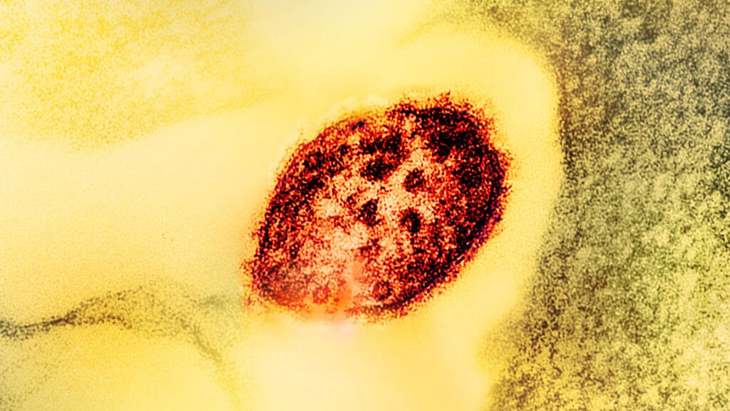 Pour lutter contre la recrudescence de la rougeole, «il faut une couverture vaccinale élevée» 1 Selon l’Organisation mondiale de la santé, 120 pays présentent un risque élevé de résurgence de la rougeole (sur ce cliché, micrographie électronique à transmission colorée d’une particule, en rouge, du virus de la rougeole).